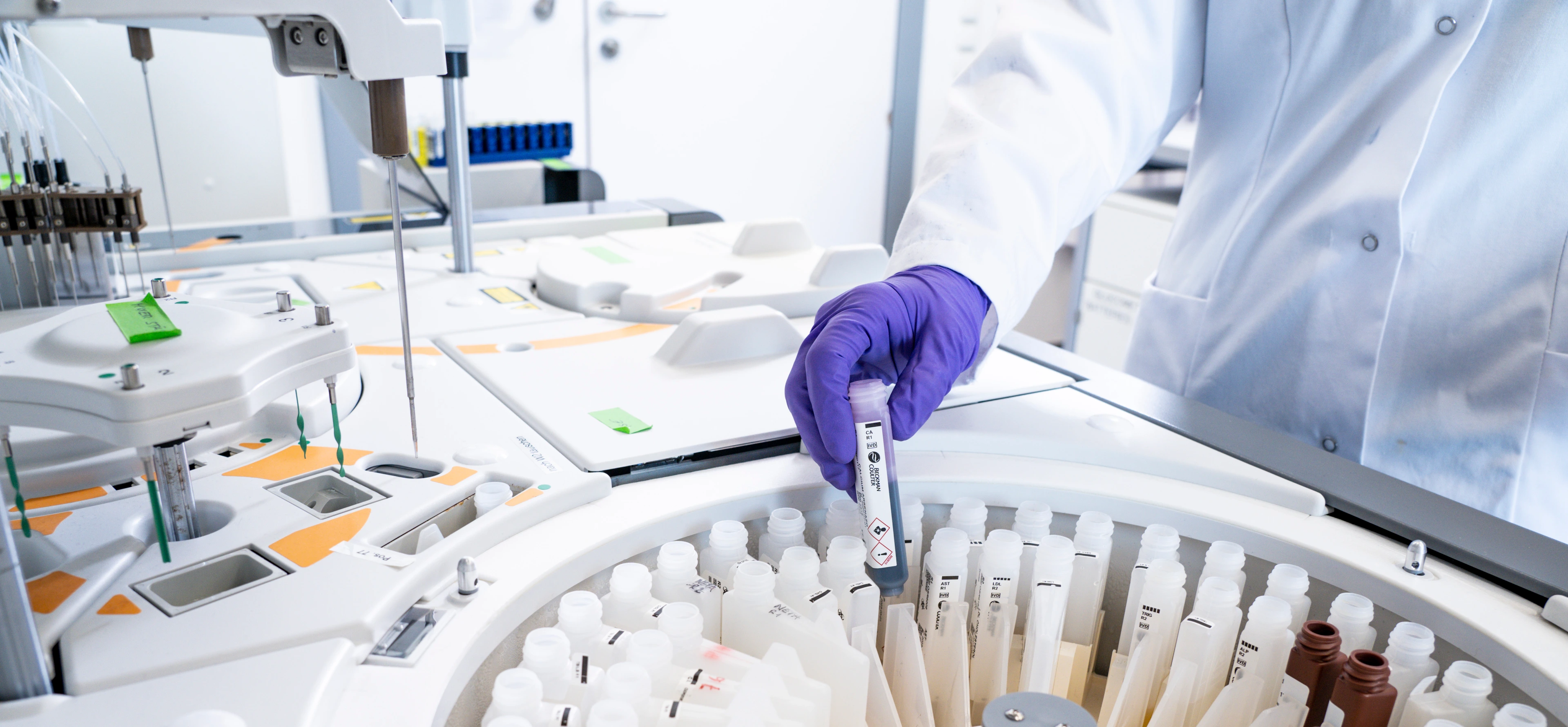 IDC Labor, Serum Analyzer, Befüllung mit Testreagenzien