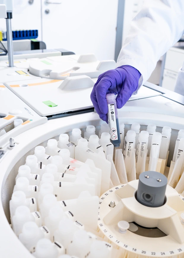 Centrifuge with blood samples I ©Matthias Tunger Photodesign