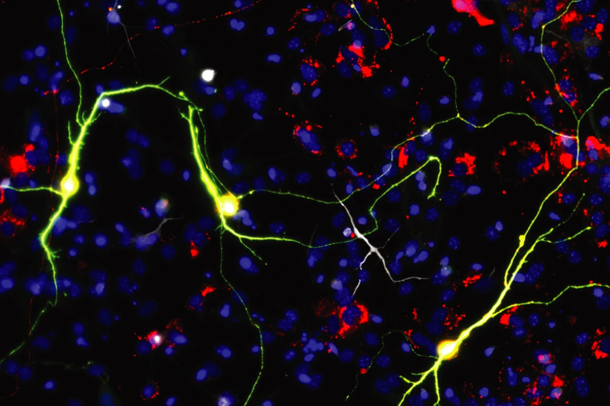Reprogrammed neurons upon Ascl1 expression and neuron-enriched mitochondrial proteins.