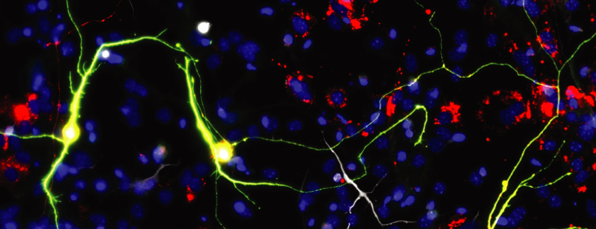 Reprogrammed neurons upon Ascl1 expression and neuron-enriched mitochondrial proteins.