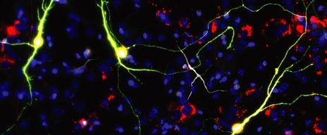 Reprogrammed neurons upon Ascl1 expression and neuron-enriched mitochondrial proteins.