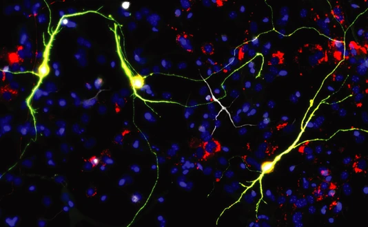 Reprogrammed neurons upon Ascl1 expression and neuron-enriched mitochondrial proteins.