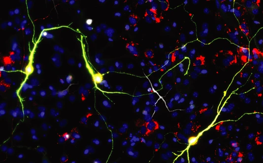 Reprogrammed neurons upon Ascl1 expression and neuron-enriched mitochondrial proteins.