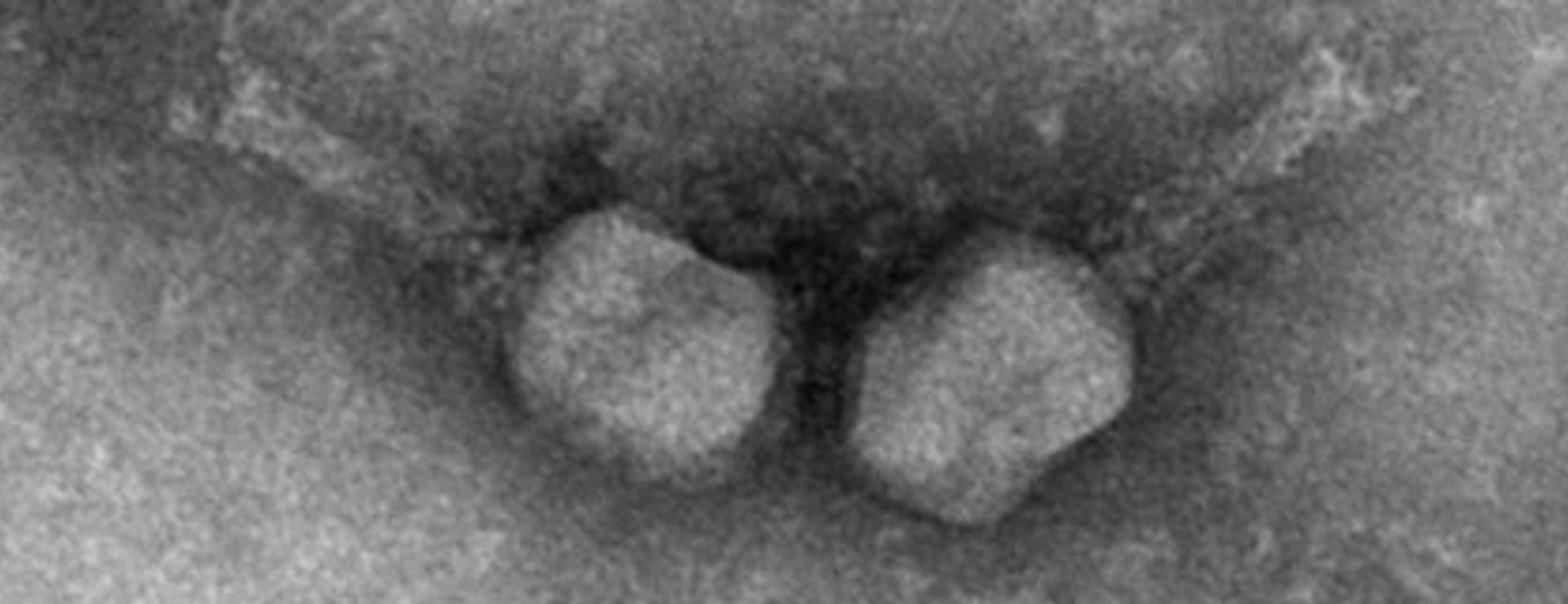 Electron micrograph of two T4-like phages.