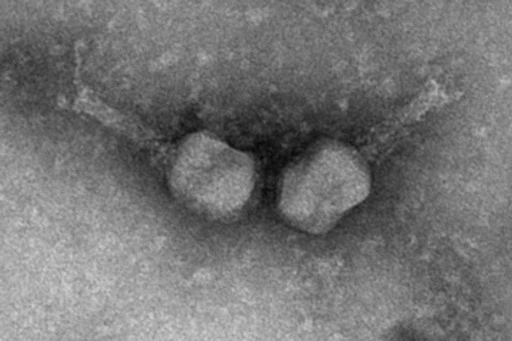 Electron micrograph of two T4-like phages.