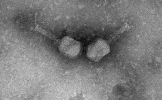 Electron micrograph of two T4-like phages.