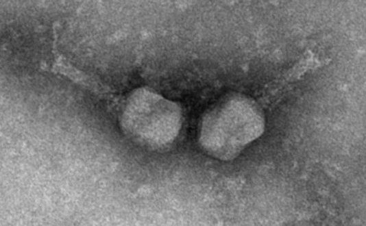 Electron micrograph of two T4-like phages.
