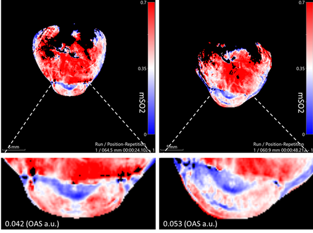 VGujrati Metabolic Imaging