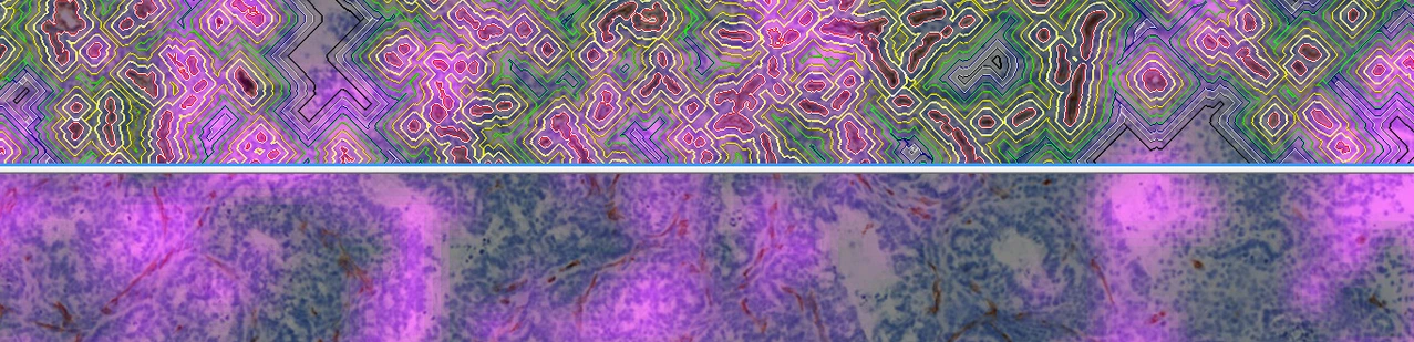 AAP_banner_DistanceMap Irinotecan2