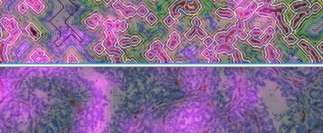 AAP_banner_DistanceMap Irinotecan2