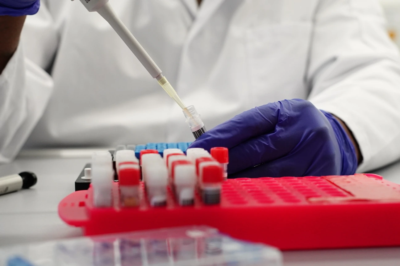 NAKO und BABYDIAB Proben