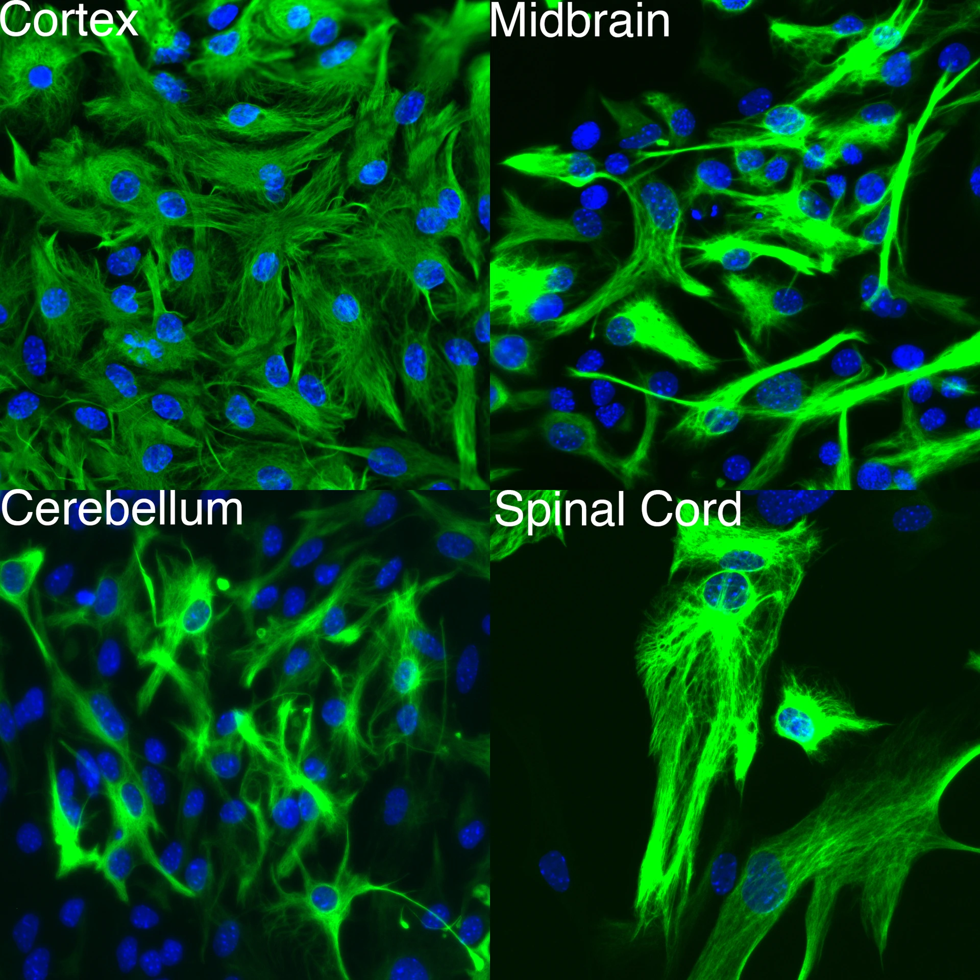 AstrocyteHeterogeneity_copyright_Masserdotti