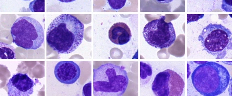 bone marrow cells
