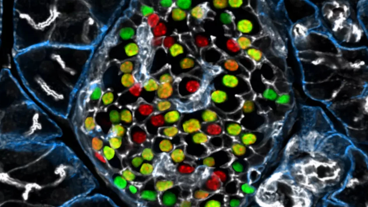 IDR Beta cell Heterogeneity