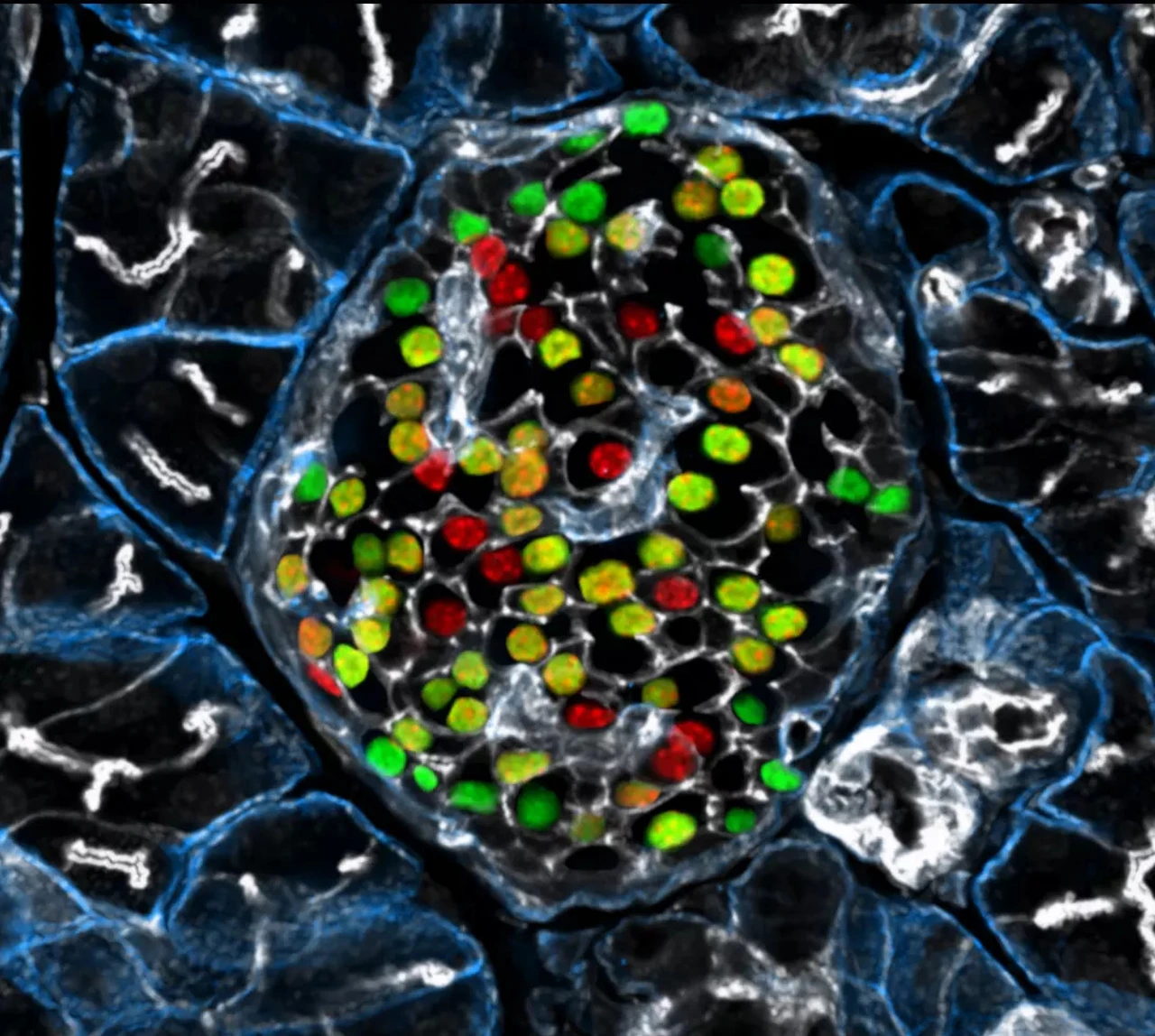 IDR Beta cell Heterogeneity