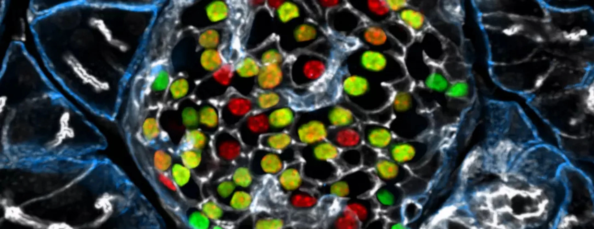 IDR Beta cell Heterogeneity