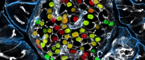 IDR Beta cell Heterogeneity