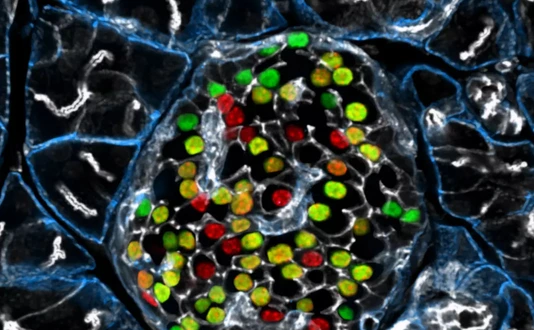 IDR Beta cell Heterogeneity