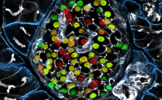 IDR Beta cell Heterogeneity
