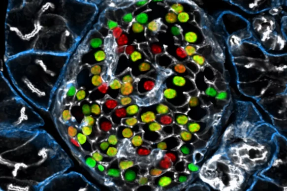 IDR Beta cell Heterogeneity