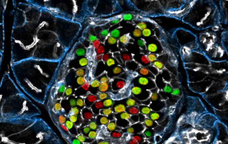 IDR Beta cell Heterogeneity