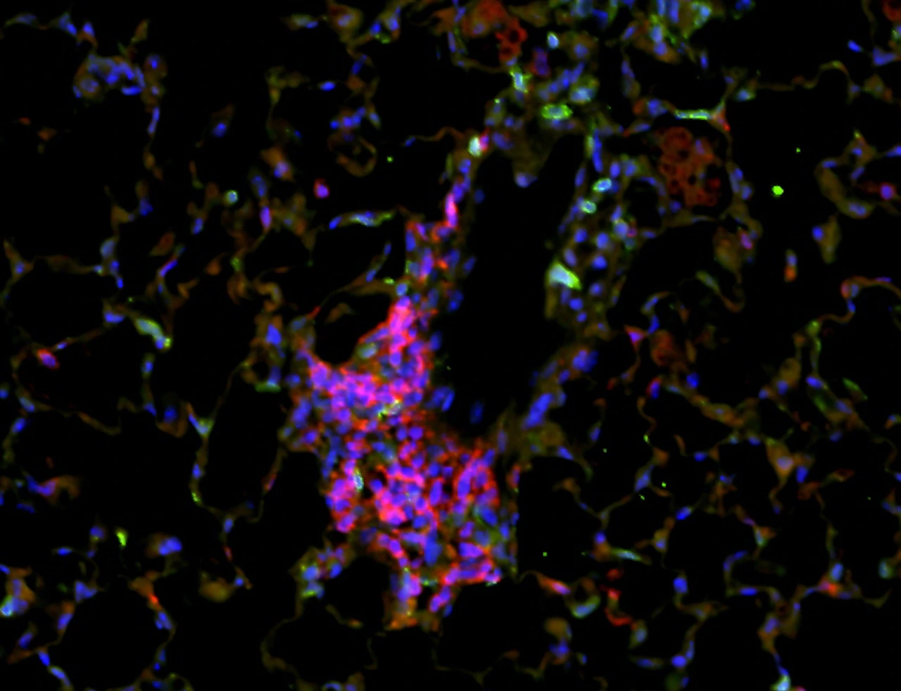 Lung section from mice
