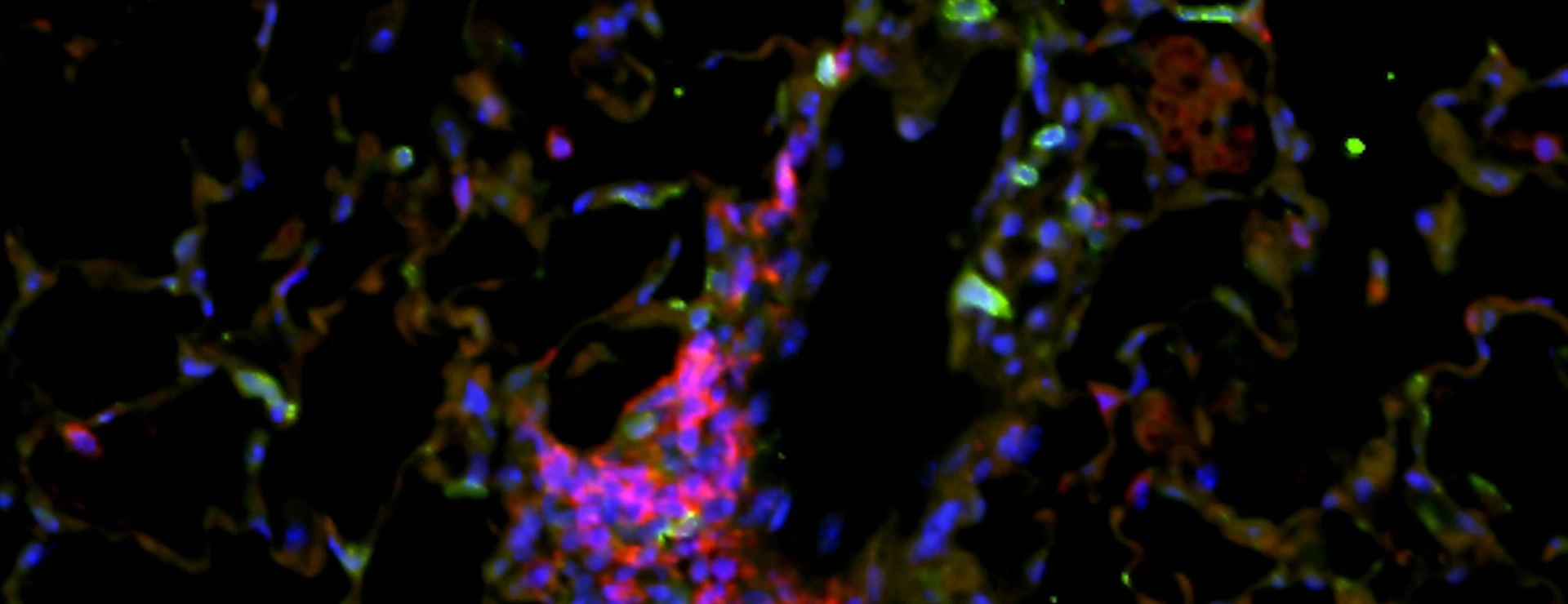 Lung section from mice