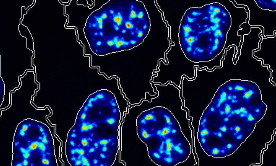 Battich_Lab_Picture_cell_segmentation