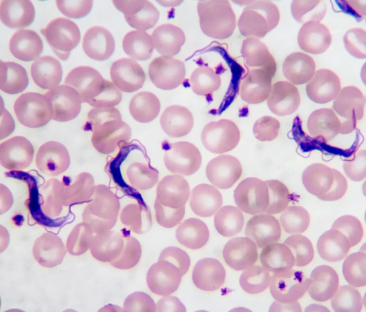Trypanosoma gambiense blood smear viewed under a microscope at 1250 power.