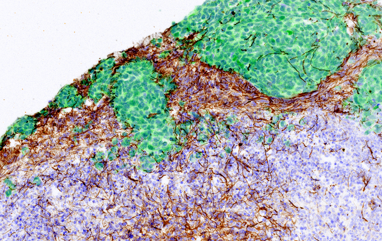 merged_DAPI_GFP_GFAP_SERPIN_2_12_22_15_CNSR_ISF