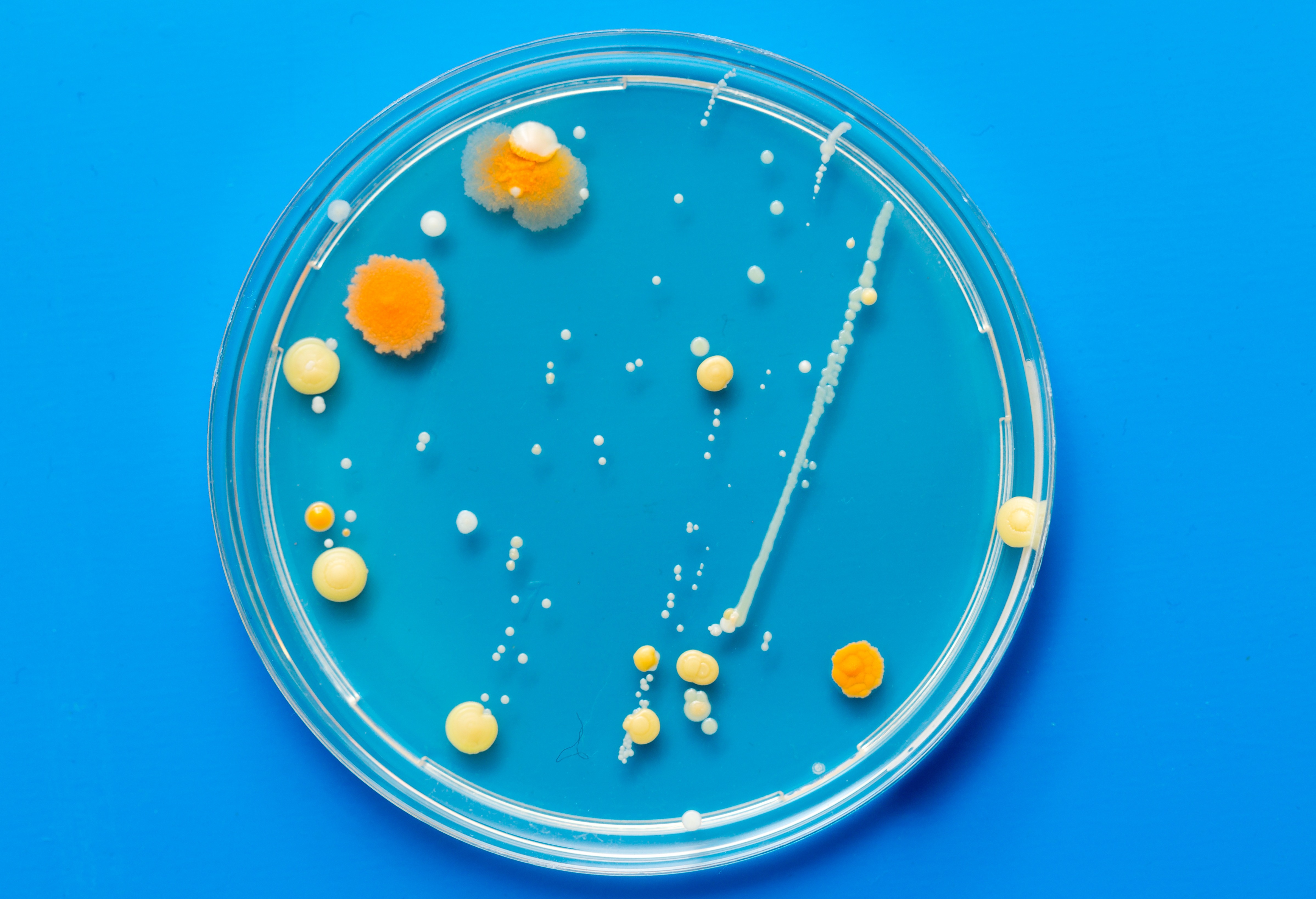 A petri dish with growing cultures of microorganisms, fungi and microbes. A Petri dish  ( Petrie dish) known as a Petri plate or cell-culture dish