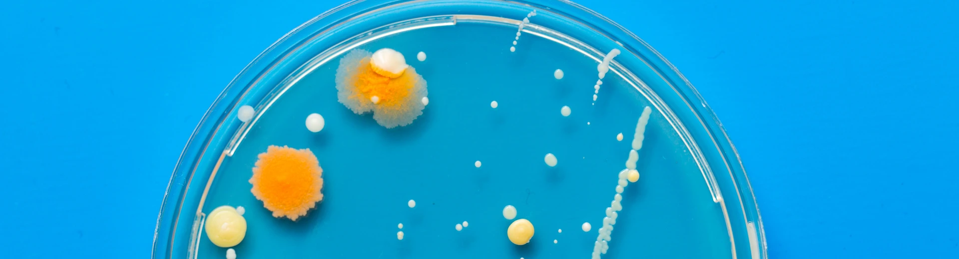 A petri dish with growing cultures of microorganisms, fungi and microbes. A Petri dish  ( Petrie dish) known as a Petri plate or cell-culture dish