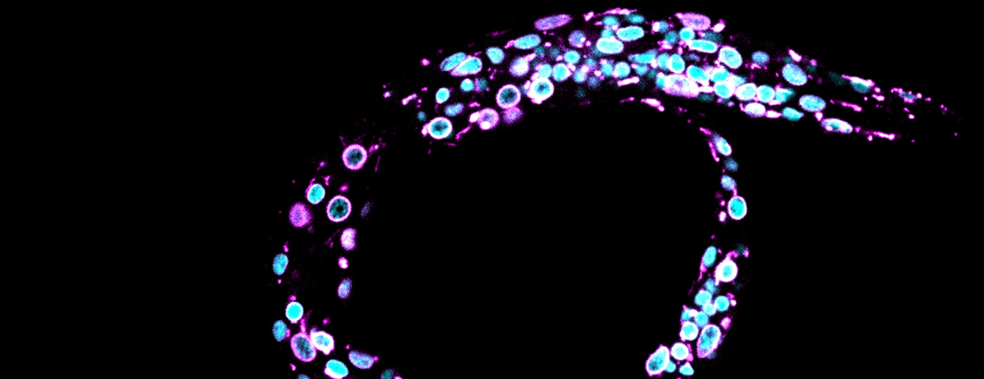 Cabianca_Celegans_Larvae1