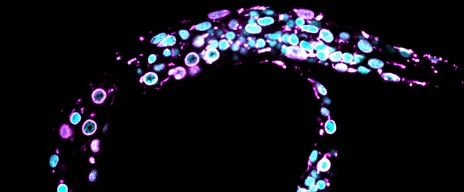 Cabianca_Celegans_Larvae1
