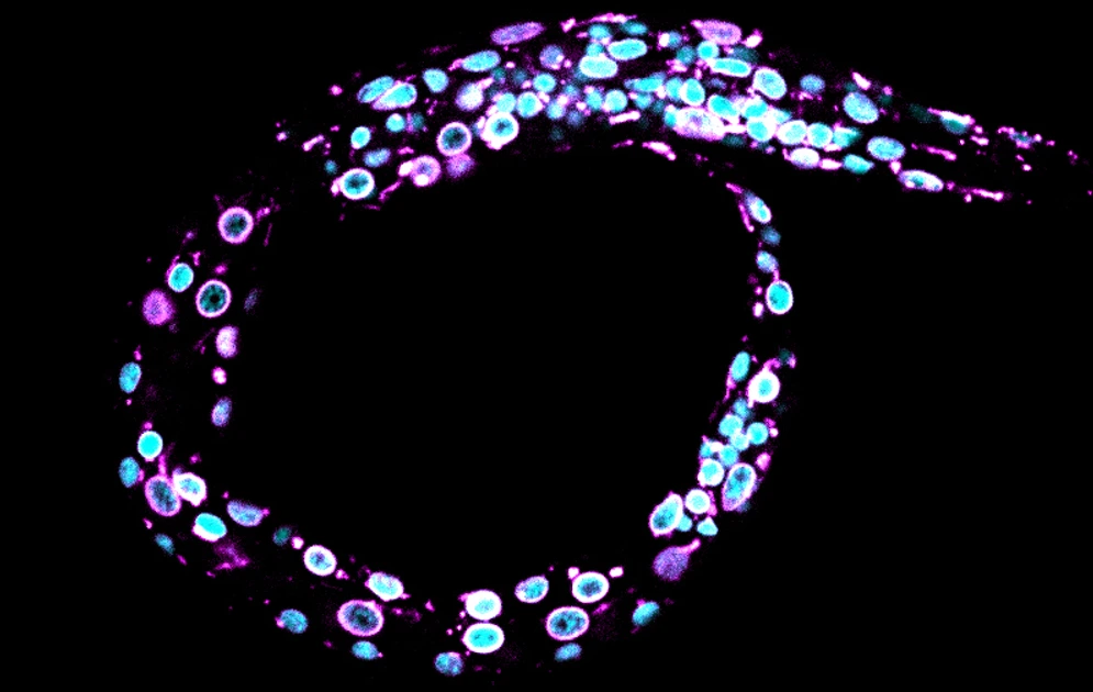 Cabianca_Celegans_Larvae1