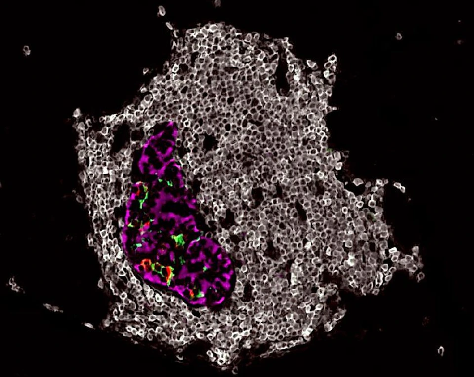 Rodriguez-Calvo_insulitis