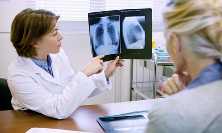 PNEUMOLOGIE CONSULTATION SENIOR