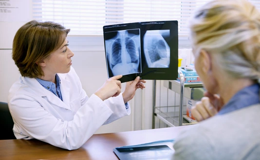 PNEUMOLOGIE CONSULTATION SENIOR