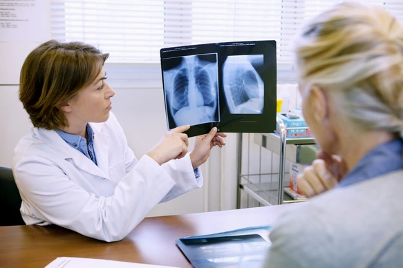 PNEUMOLOGIE CONSULTATION SENIOR