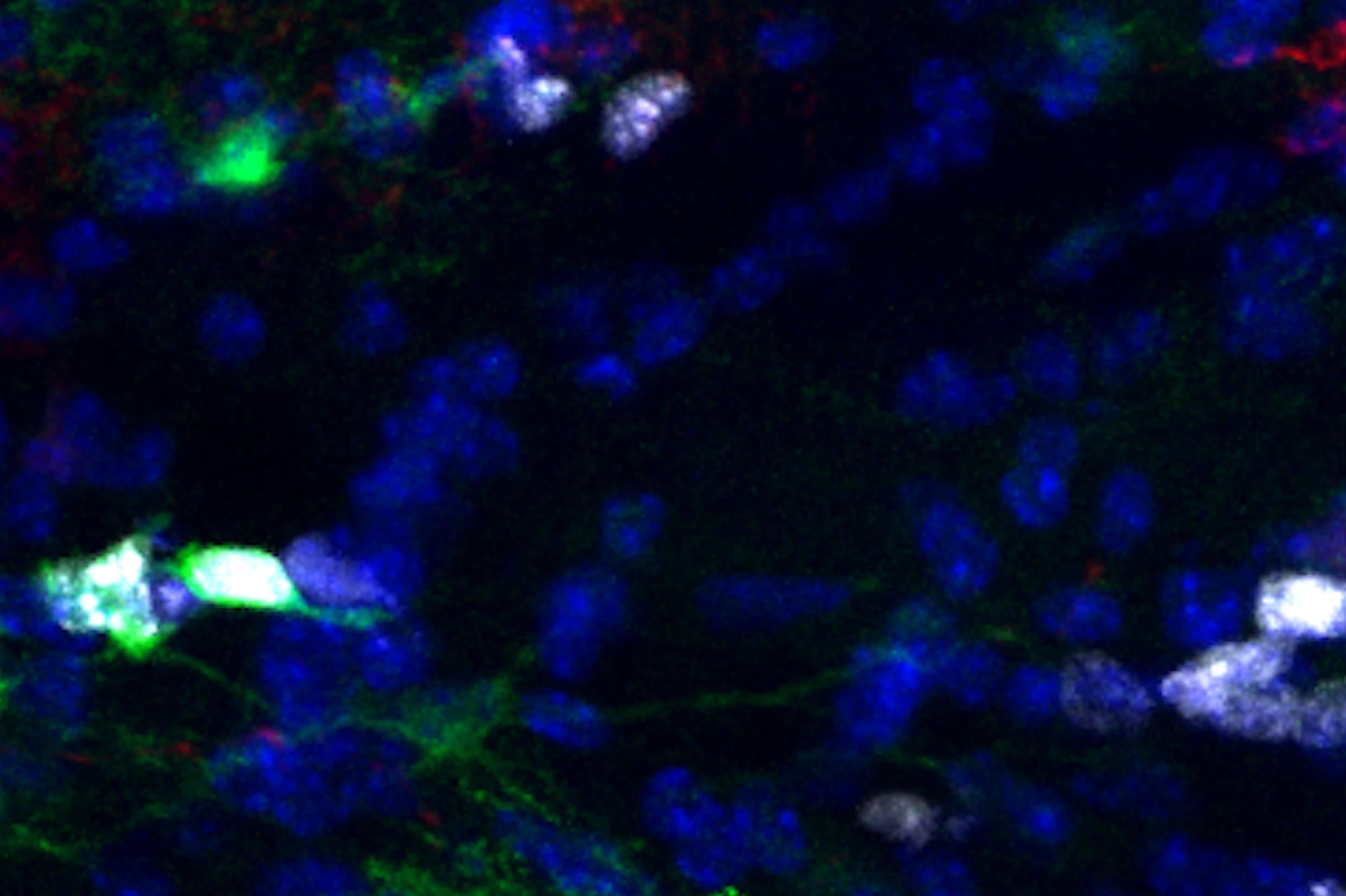 Proliferative Astrocytes in the white matter of the murine brain.