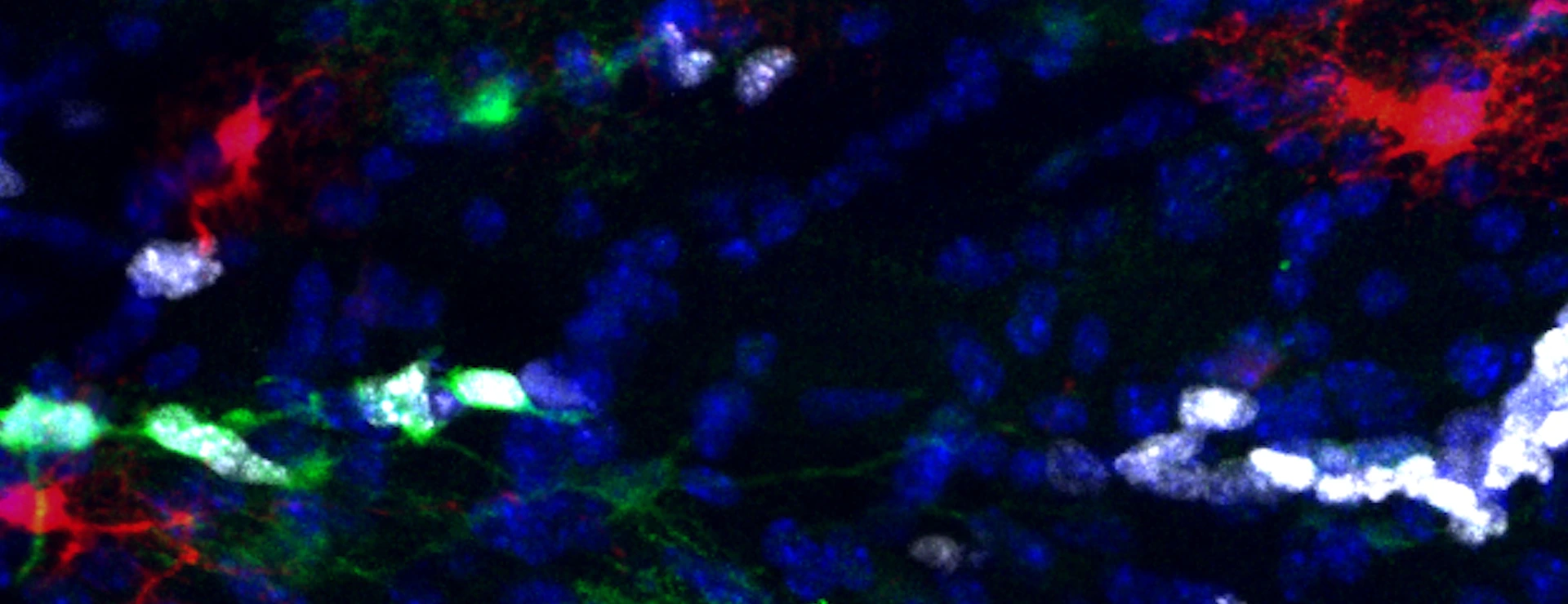 Proliferative Astrocytes in the white matter of the murine brain.
