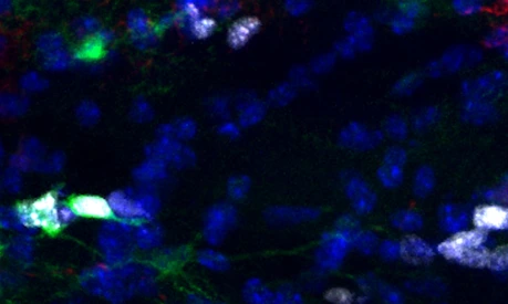 Proliferative Astrocytes in the white matter of the murine brain.