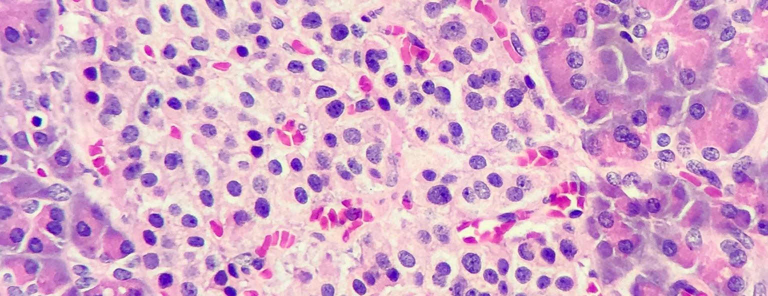 Islets of langerhans