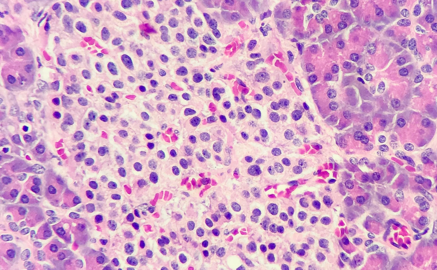 Islets of langerhans