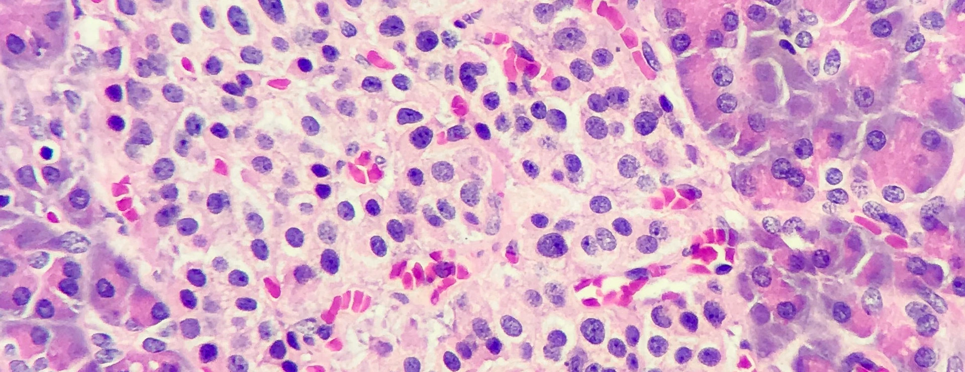 Islets of langerhans