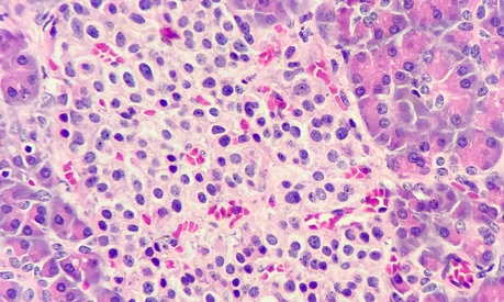 Islets of langerhans