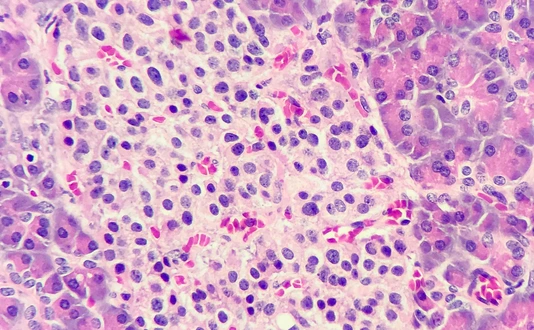 Islets of langerhans