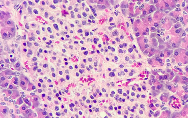 Islets of langerhans