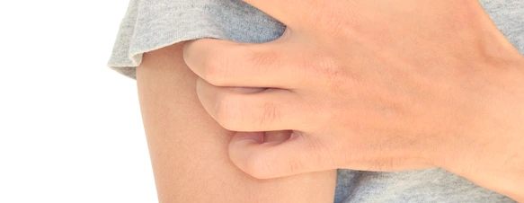 Neurodermitis