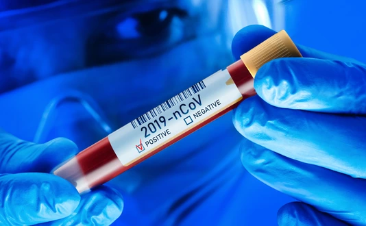 2019-nCoV Corona Virus Blood Test Concept
